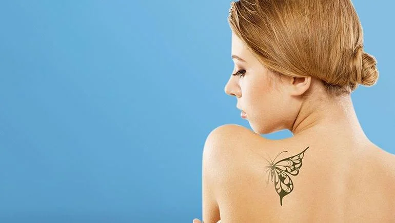 Laser Tattoo Removal in Wagholi Pune by Dr Vandana Sharma